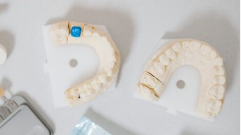 Avantajele colaborării cu un laborator de tehnică dentară de top - Ce înseamnă asta pentru medicii stomatologi?
