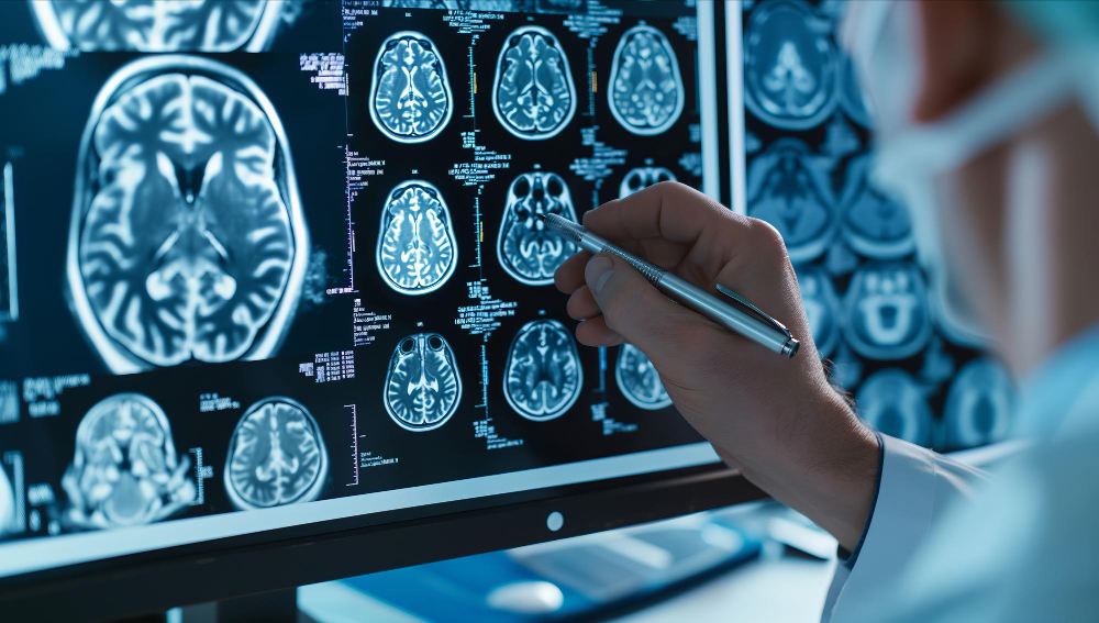 Situatii care recomanda o programare pentru o consultatie neurologica