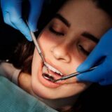 Fațetă sau coroană dentară ? Unde trece granița dintre cele două, explicat de Gentle Dentist