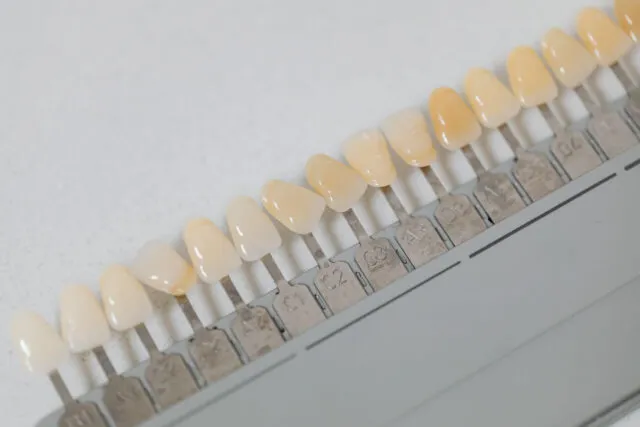Albirea dentară după prima ședință - ce este normal să observi
